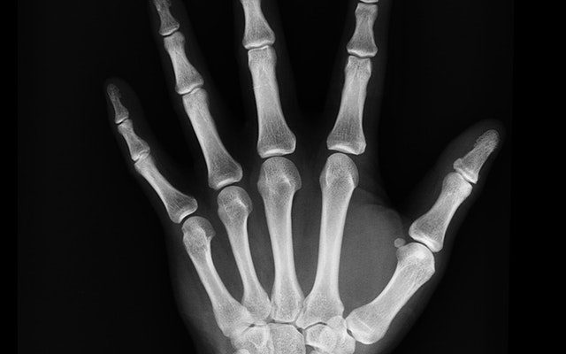 black-and-white-bones-hand-207496